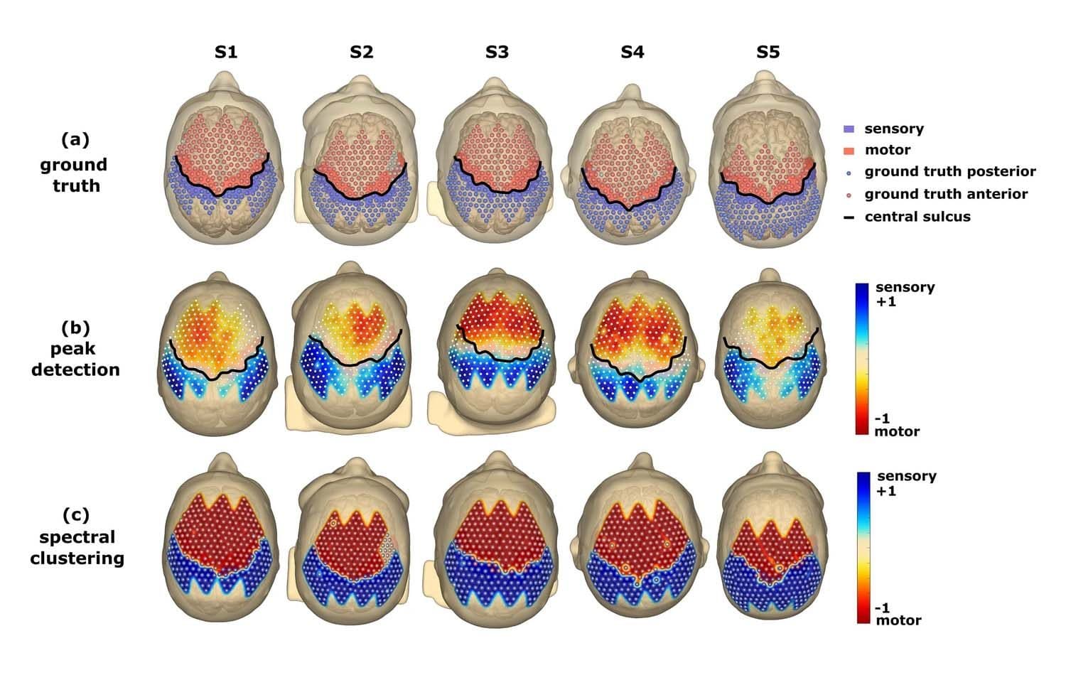 Ground truth, peak detection and spectral clustering of the central sulcus in five participants