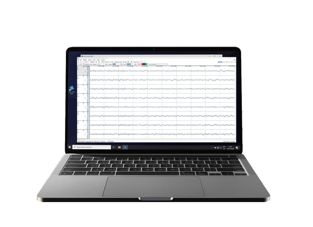g.Recorder'da ham EEG görünümü