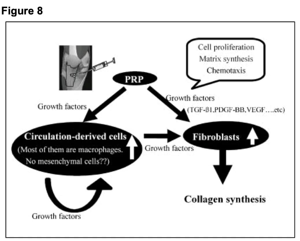 Schematic relationships between PRP, growth factors, fibroblasts and collagen synthesis