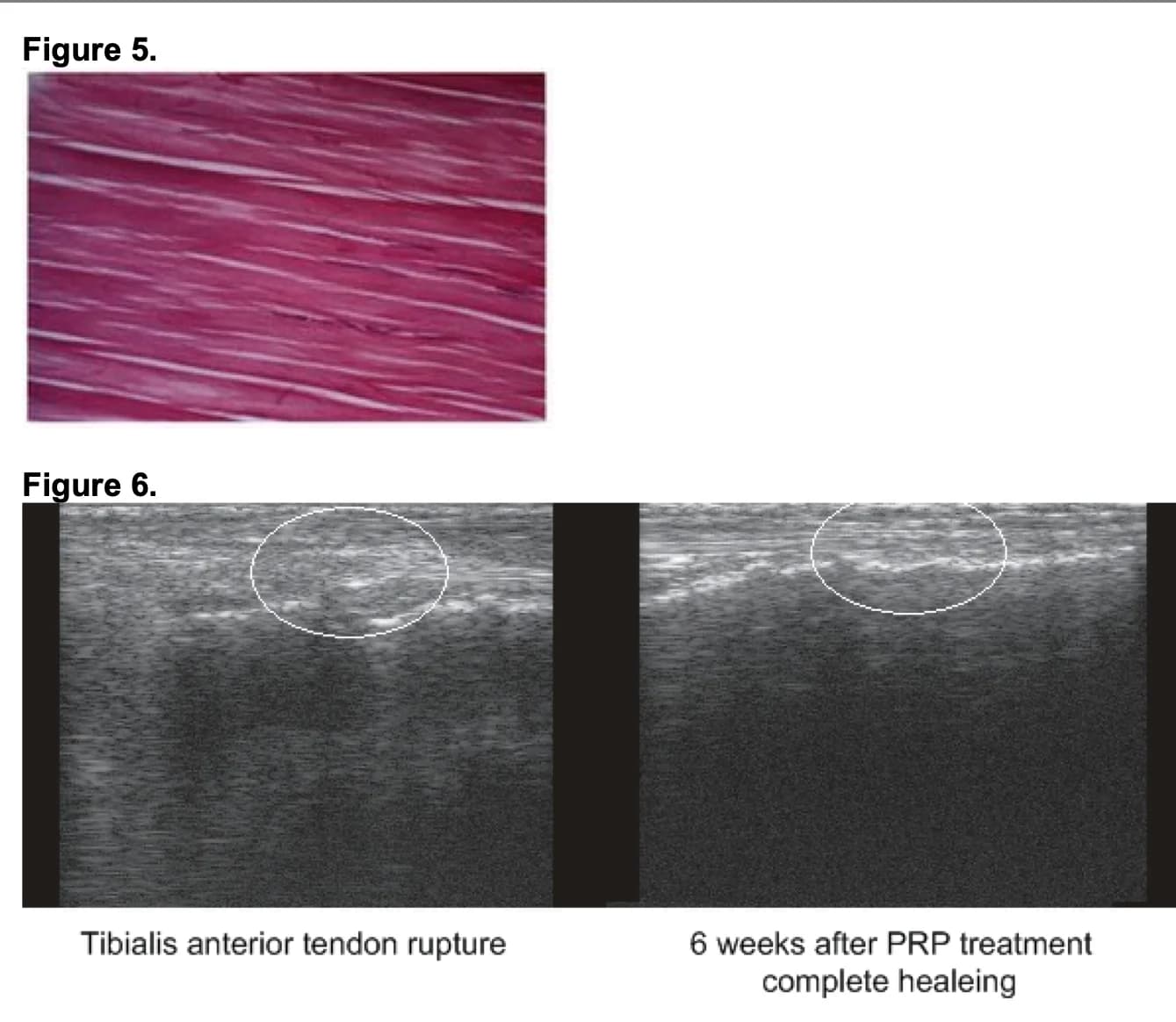 Tendon histology and serial ultrasound images of the tibialis anterior tendon