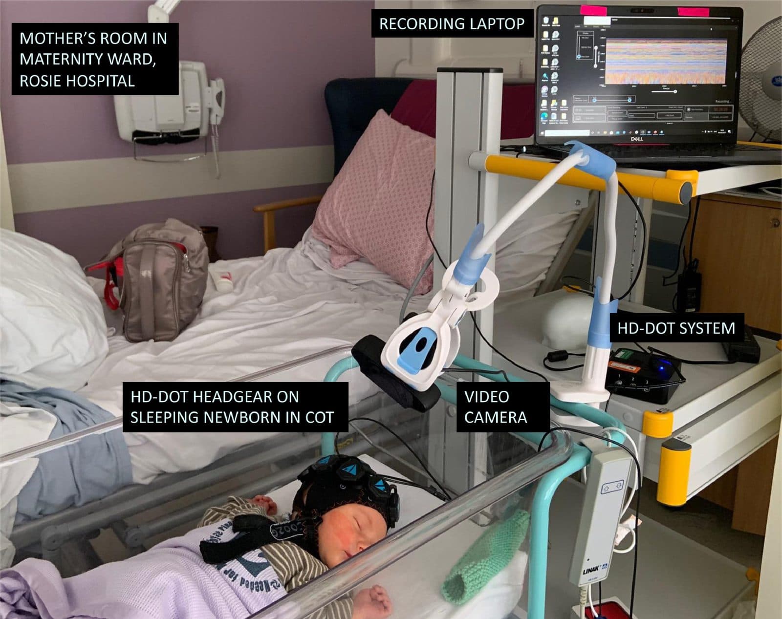 A cot-side HD-DOT set-up on a sleeping newborn in a maternity ward