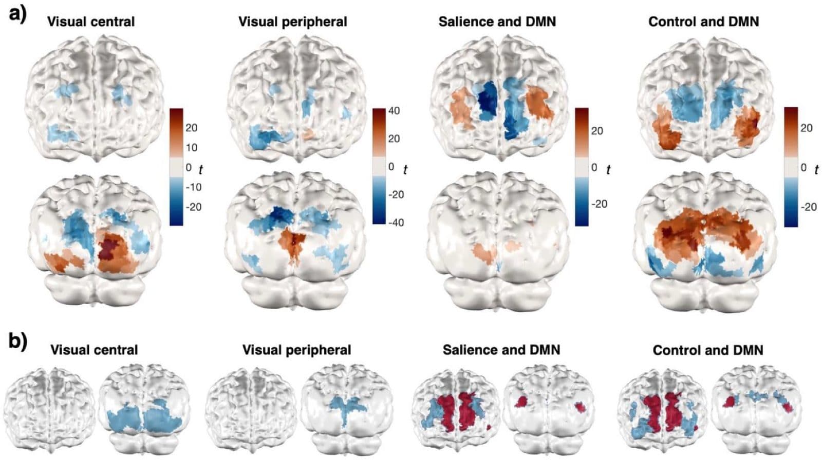 Brain maps of resting-state networks recorded at home