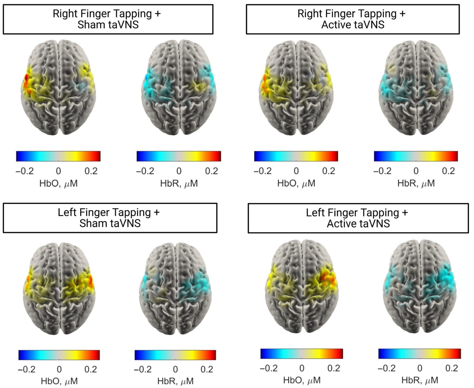 Cortical response maps for finger tapping with and without taVNS