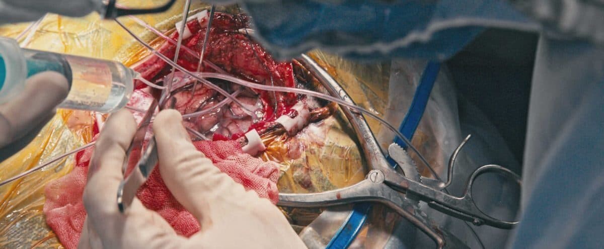 Electrode cables placed on the surface of the brain during an open craniotomy, with a gloved hand, a syringe and metal retractors