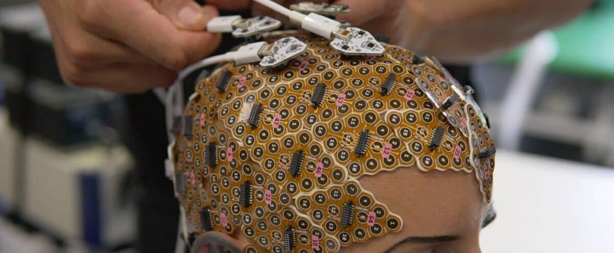 Gold-coloured g.Pangolin electrode grids of hundreds of numbered electrodes stuck to a participant’s scalp, with cables being attached to them
