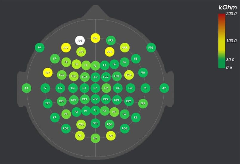 An impedance map over 64 channels